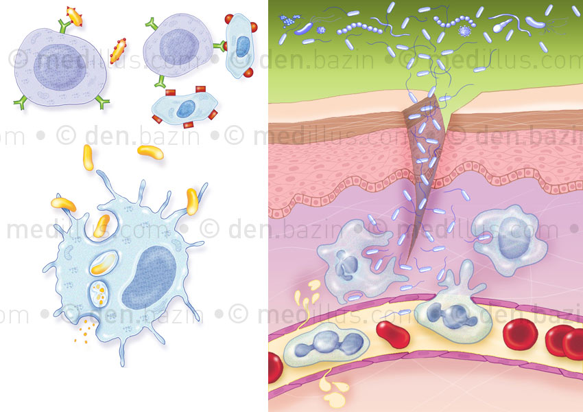 Globules blancs et infection