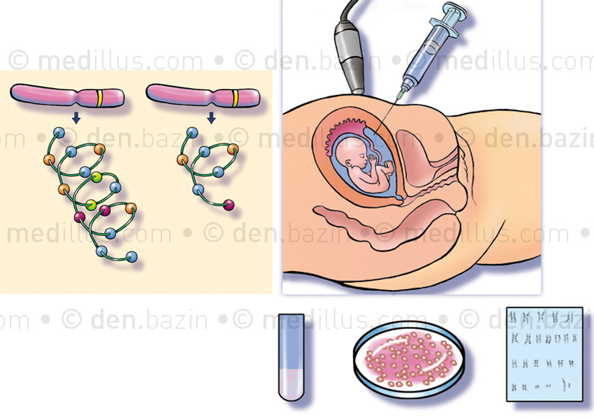 Analyse de chromosomes