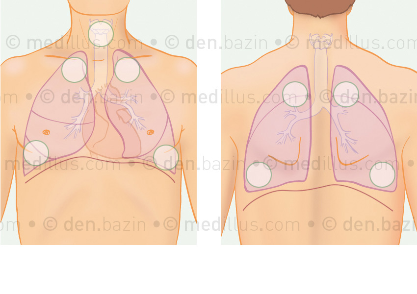 Auscultation cardiaque