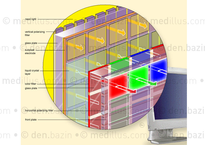 Ecran plat LCD