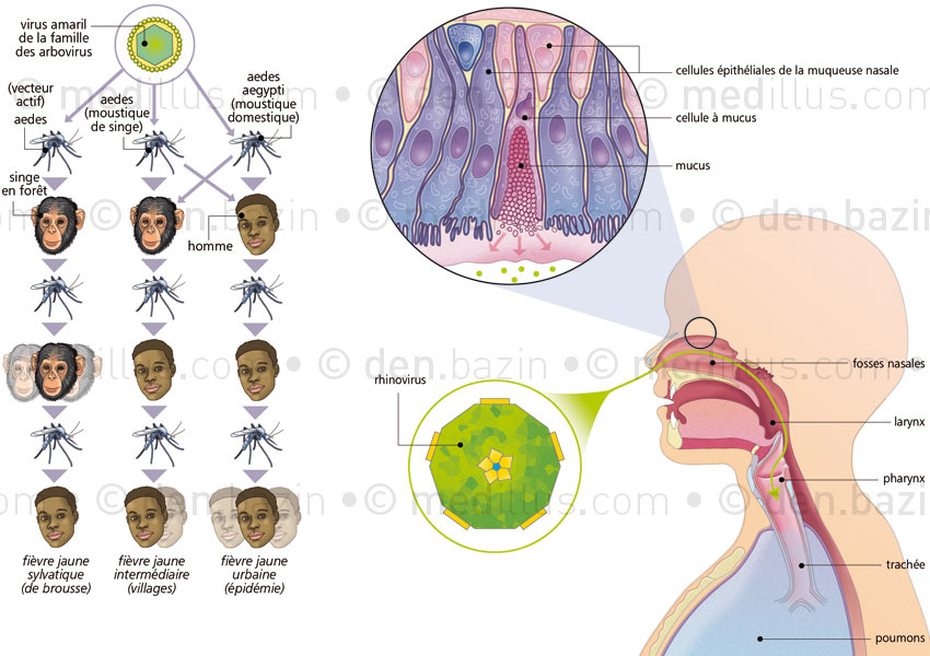 Transmission des différentes fièvres jaunes et rhinite
