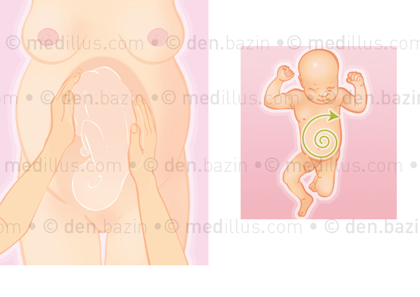 Manœuvre de retournement et massage abdominal du nouveau-né