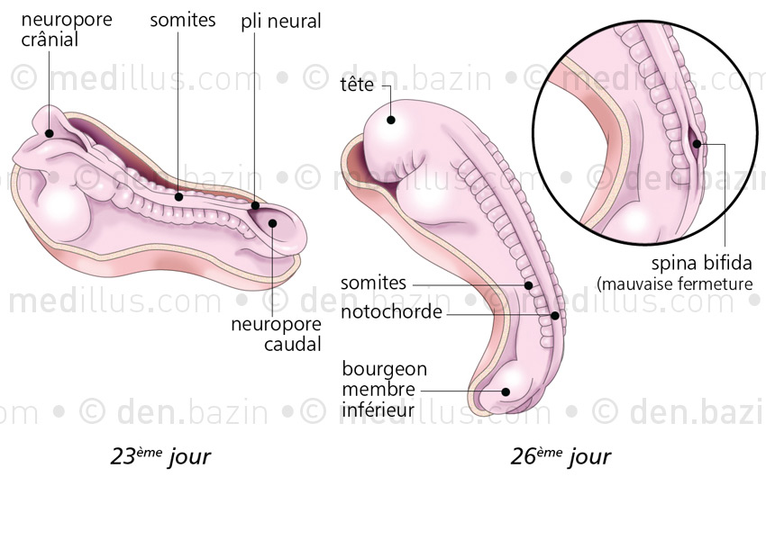 Fermeture du pli neural