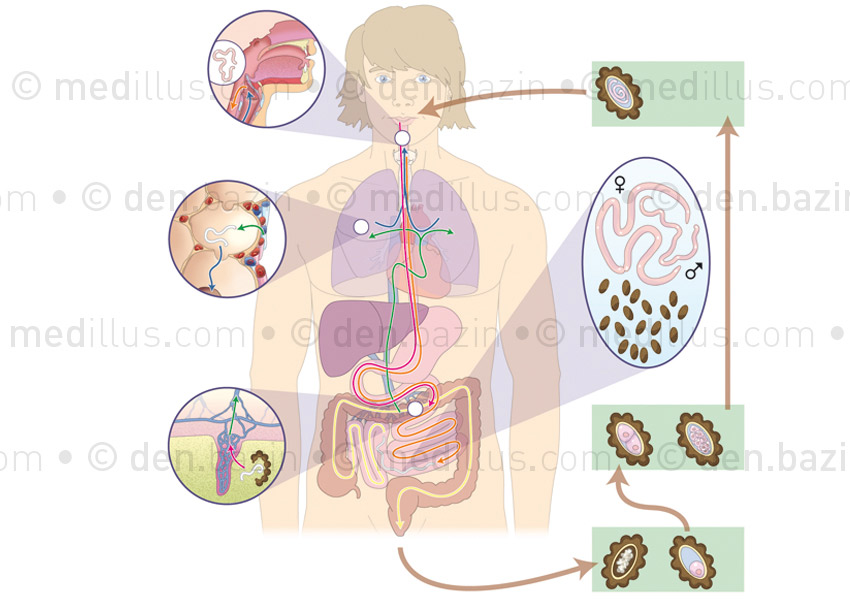 Cycles des ascaris et atteintes de l'ascaridiase