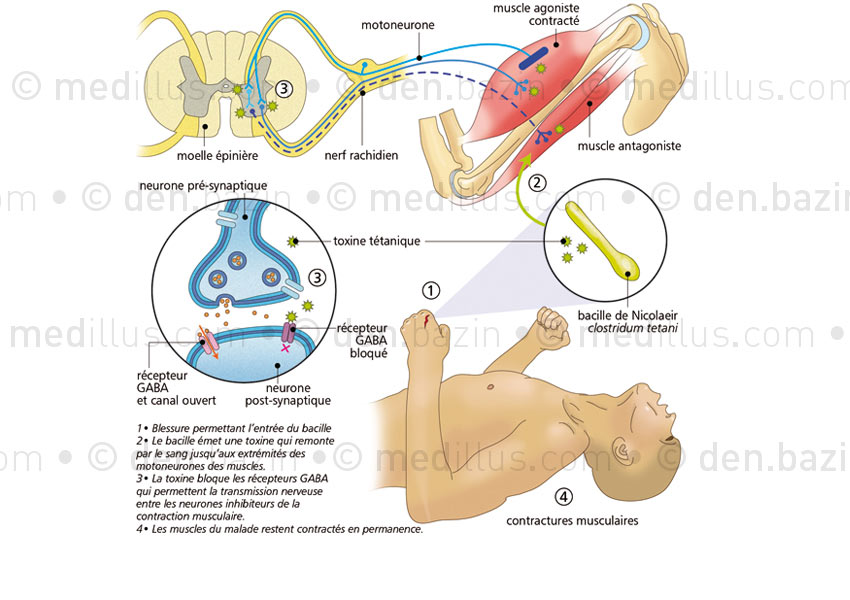 Mécanisme des atteintes nerveuses du tétanos