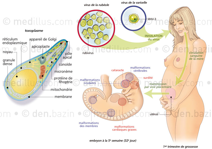 Toxoplasme, et atteintes de la varicelle et de la rubéole