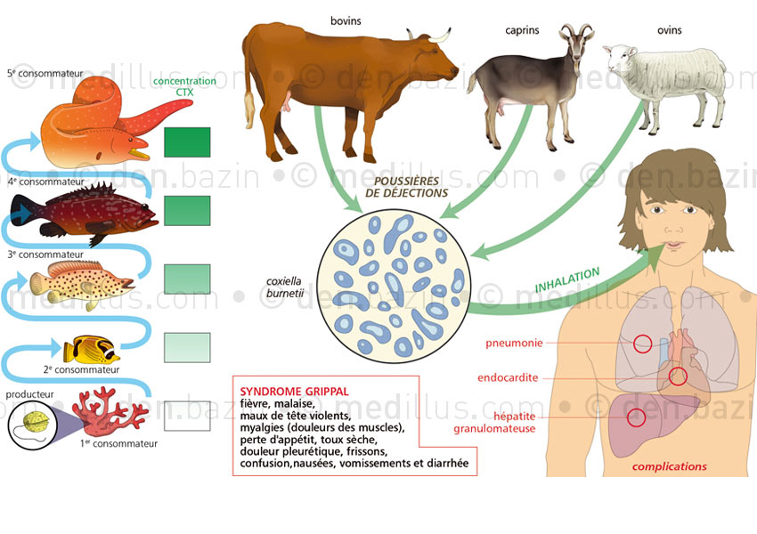 Concentration de la toxine du ciguatera et contamination de la fièvre Q