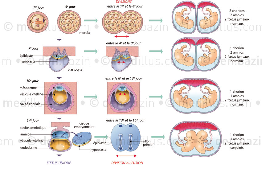 Divisions embryonnaires et conséquences sur les fœtus