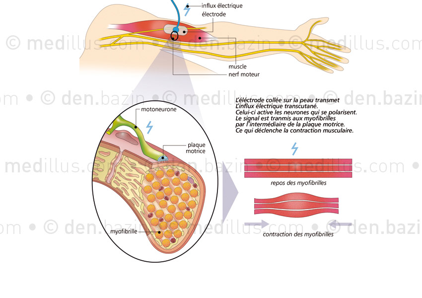 Électrostimulation